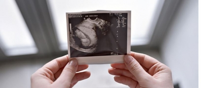 «Вынужденная потеря»: зачем прерывать беременность на поздних сроках и как это делают в Красноярске